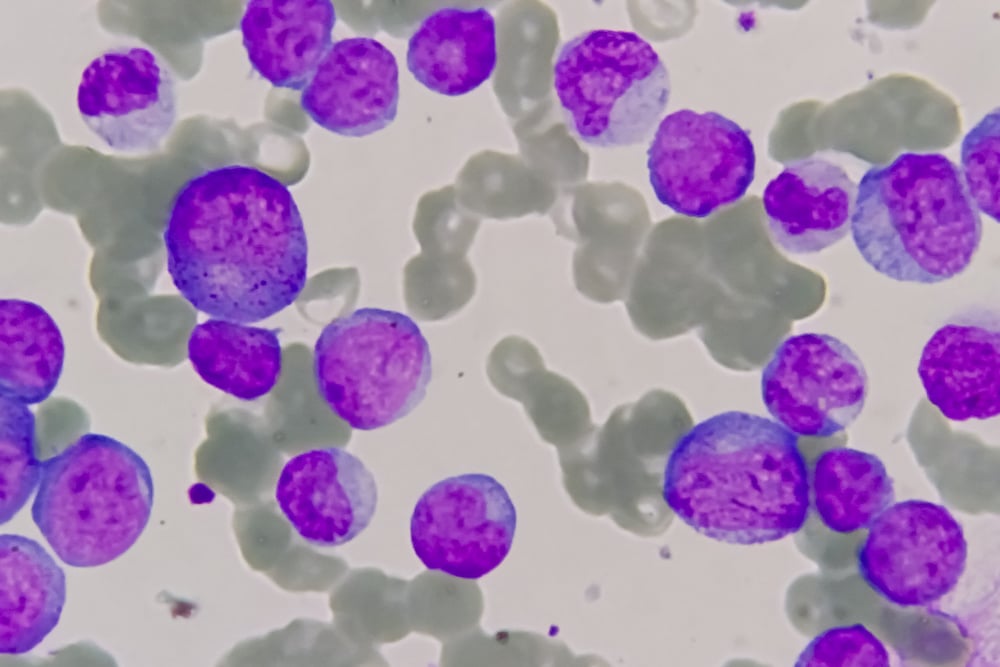 Purple cells shown over a background of greyscale cells.