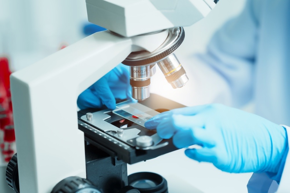 Hands with blue gloves put slide under a microscope