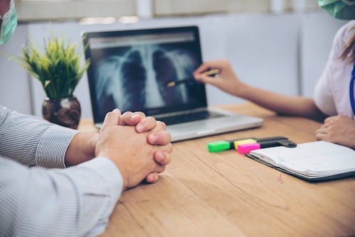 médico revisando radiografías de cáncer de pulmón