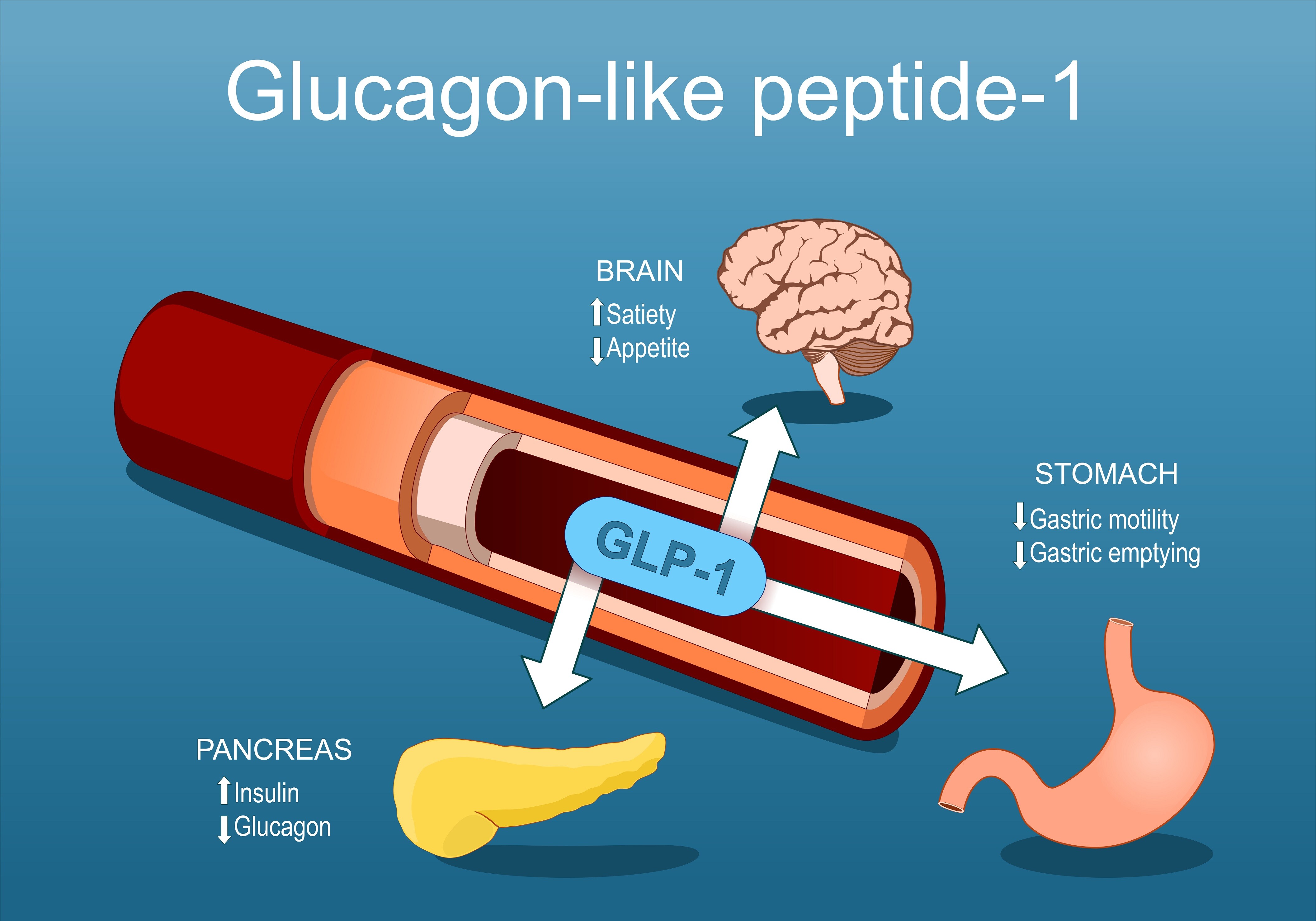 ¿Qué efectos tendrán los agonistas del GLP-1 en el cáncer?